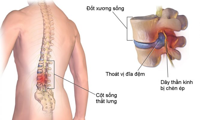 Bieu-hien-cua-thoat-vi-dia-dem