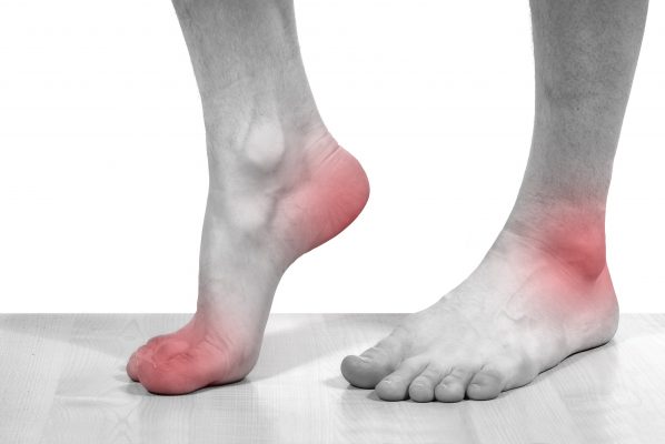 Dấu hiệu của bệnh tràn dịch khớp cổ chân - Nhà Thuốc Vivita