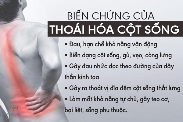 chua-thoai-hoa-cot-song-bang-dong-y-va-nhung-dieu-can-luu-y