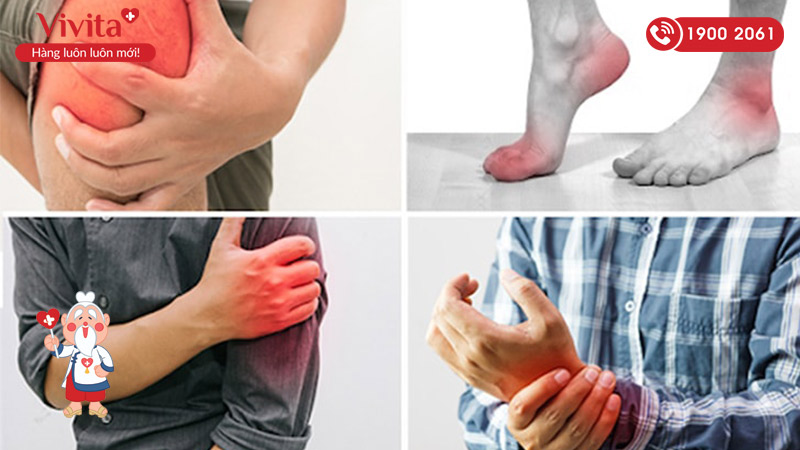 Triệu chứng của viêm khớp