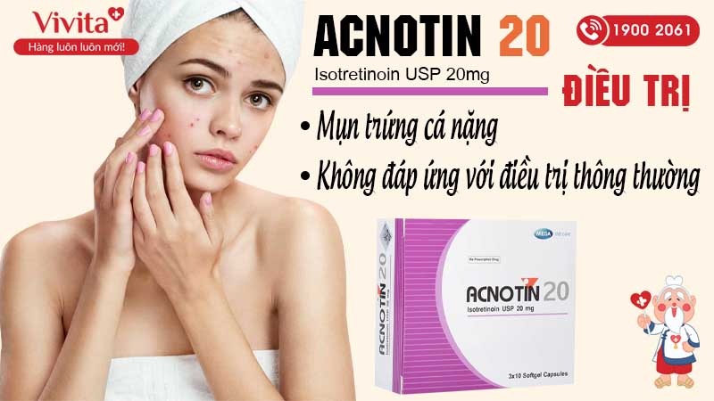 Công dụng thuốc Acnotin 20