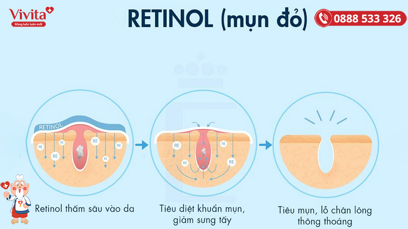 Retinol chống lão hoá và trị mụn hiệu quả