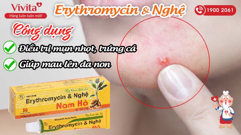 Công dụng (Chỉ định) kem trị mụn và làm mờ sẹo Erythromycin & Nghệ Nam Hà