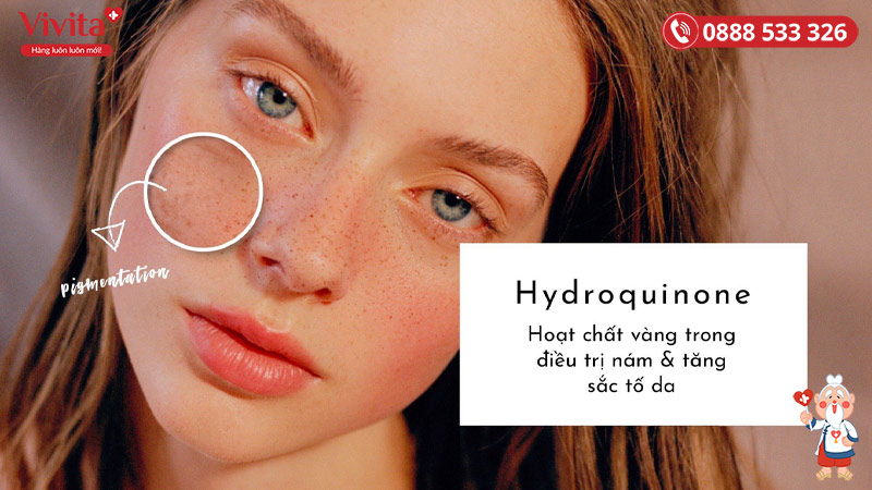 Hydroquinone là ứng viên sáng giá trong việc trị nám