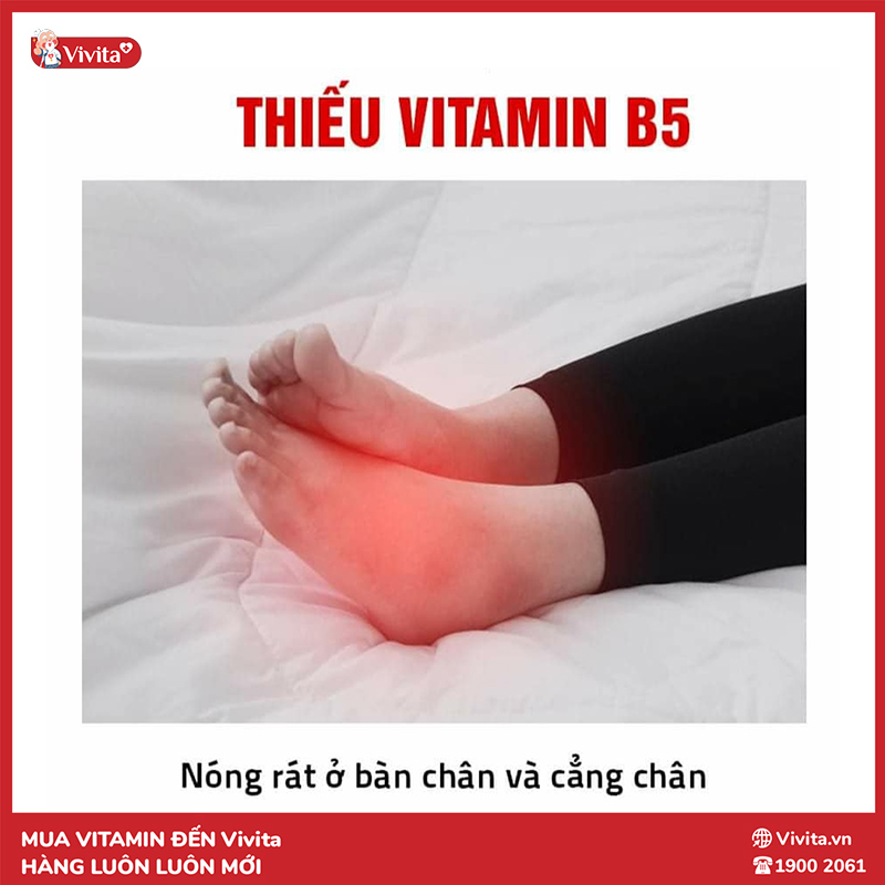 dấu hiệu thiếu vitamin b5 là bị nóng rát chân