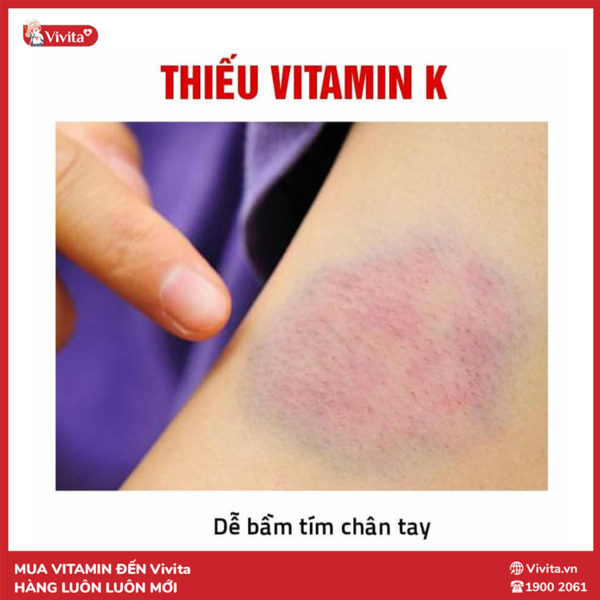 Vitamin K1,K2,K3 Là Gì? Những Thực Phẩm Giàu Vitamin K