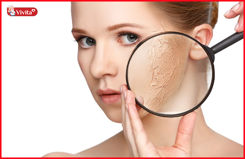 Tác dụng của vitamin C cho da mặt là hạn chế khô da