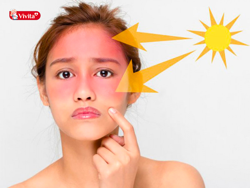 Bôi vitamin E lên da mặt rất dễ khiến da bắt nắng. Vitamin E là một chất tồn tại dưới dạng lỏng màu vàng nhạt, khó tan trong nước nhưng lại bị phân hủy bởi các tia tử ngoại. 