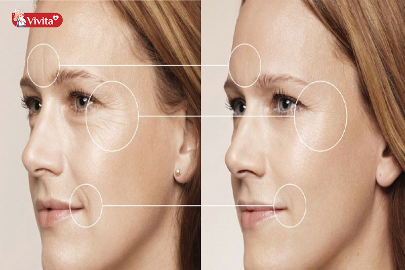 Vitamin e cải thiện nếp nhăn tốt cho da mặt