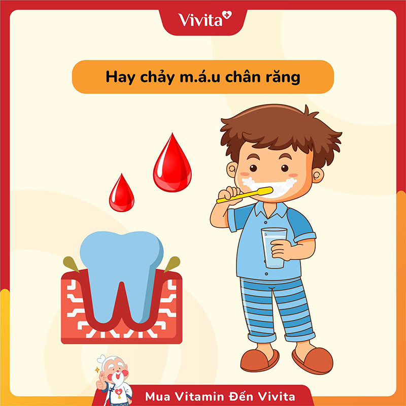 Chảy máu chân răng thường xuyên cũng là một dấu hiệu thiếu vitamin C phổ biến của cơ thể