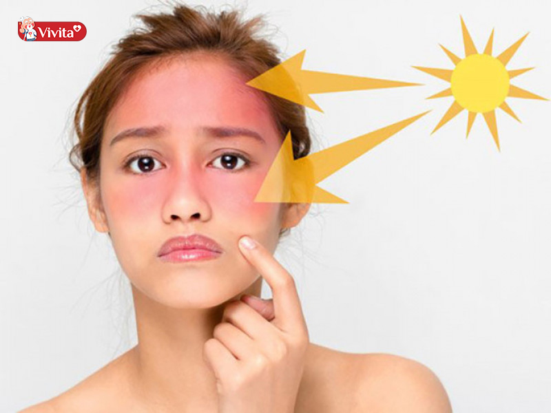 tác dụng làm dịu cháy nắng của vitamin e với làn da