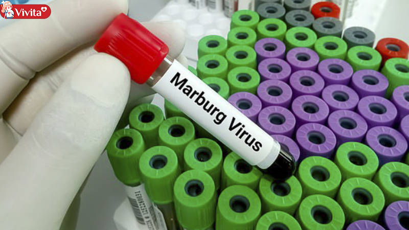 virus marburg có vắc xin phòng ngừa không? 