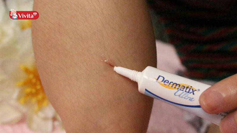 Có thể bôi trực tiếp Dermatix lên vùng da bị sẹo
