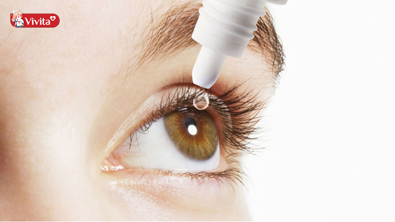Có thể sử dụng nước nhỏ mắt để tránh tình trạng khô mắt