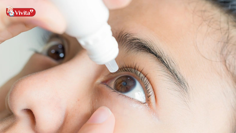 Dựa vào tình trạng bệnh để chọn thuốc nhỏ mắt phù hợp