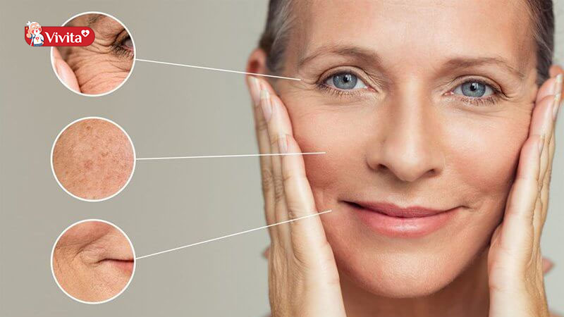 Collagen cho phụ nữ tuổi trung niên 