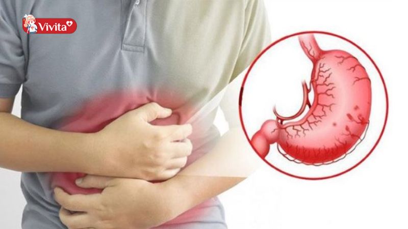 Khổ Sâm hỗ trợ điều trị viêm loét dạ dày