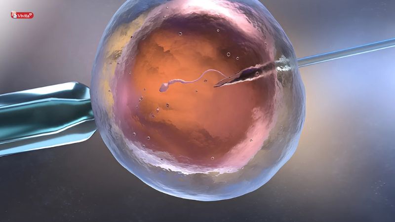 Áp dụng các phương pháp hỗ trợ hiện đại