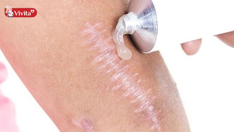 Mọi người cần tuân thủ hướng dẫn sử dụng các sản phẩm trước khi dùng
