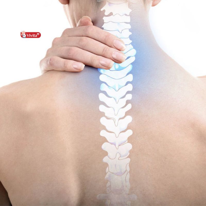 cấu trúc xương thay đổi