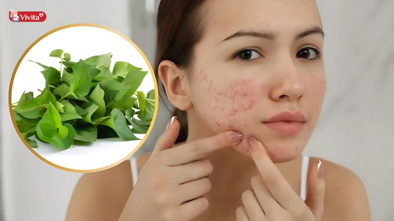 Công dụng của mặt nạ diếp cá