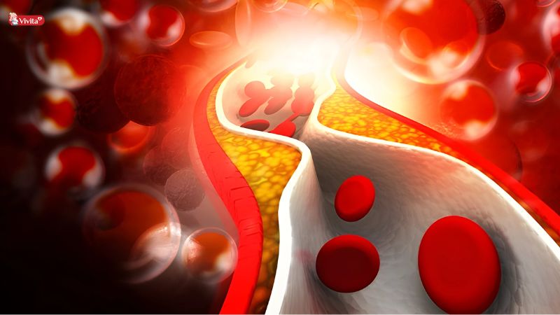 Hỗ trợ hạ lipid máu, phòng ngừa tim mạch