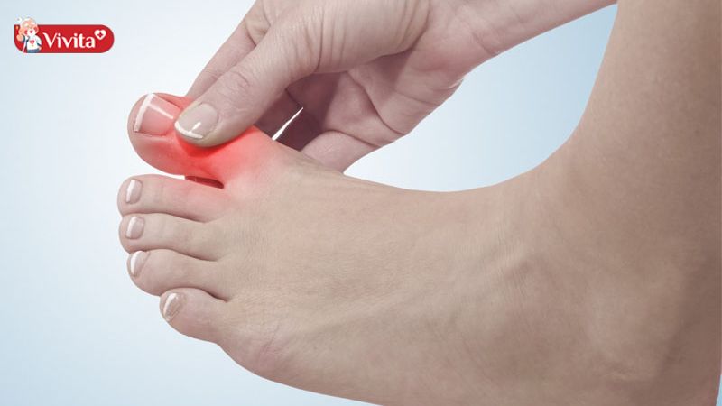 Cần thay đổi thói quen xấu ảnh hưởng tới khớp ngón chân