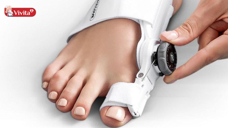 Nhiều trường hợp bị viêm khớp nặng thường sẽ phải phẫu thuật theo chỉ định bác sĩ