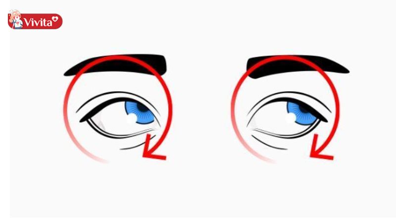 bài tập cho mắt cận