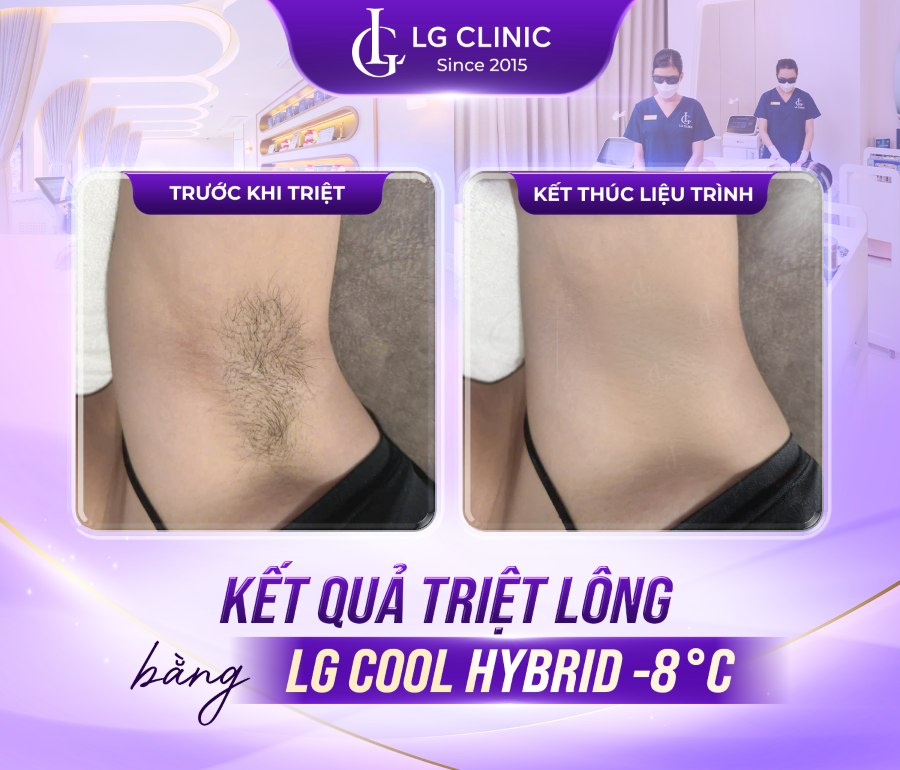 Công nghệ LG Cool Hybrid –8°C vừa triệt lông hiệu quả vừa giúp da sáng mịn hơn