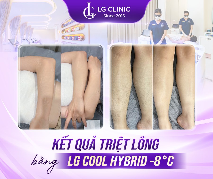LG Cool Hybrid –8°C xử lý hiệu quả vùng lông rậm như tay, chân