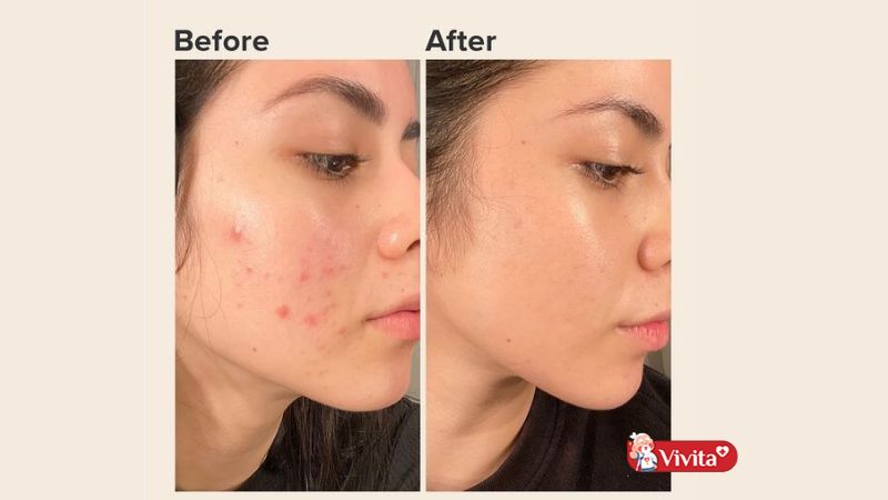Review viên uống Charmlux Anti-Aging có tốt không?