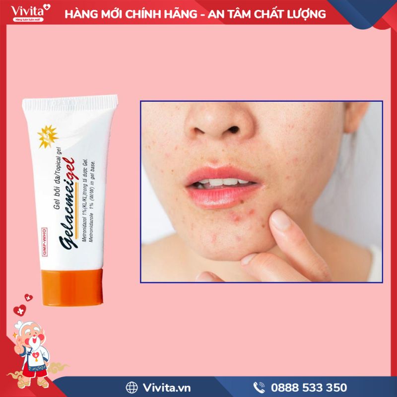 Công dụng của Gelacmeigel trị mụn