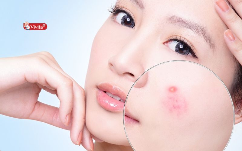 Tác dụng phụ có thể gặp khi dùng Glutathione