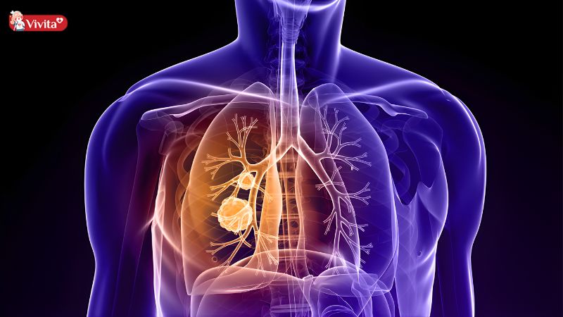 Cải thiện hệ hô hấp 