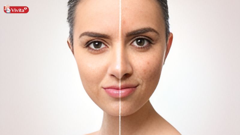 Trắng da và mờ vết thâm