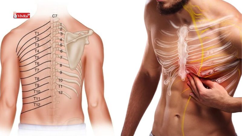 đau dây thần kinh liên sườn trái