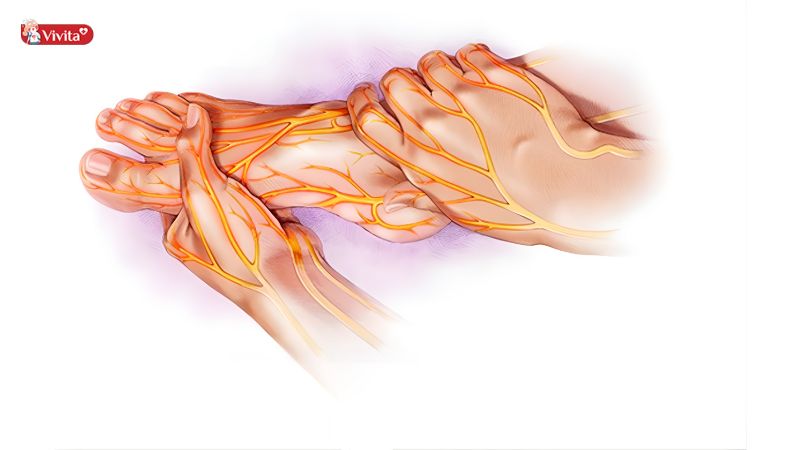 Ngứa râm ran, cảm giác bất thường ở chi