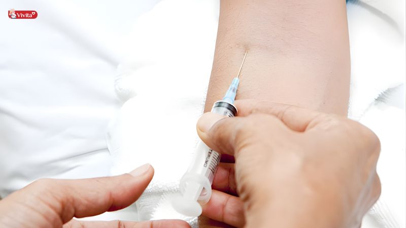 Kỹ thuật tiêm tĩnh mạch (Intravenous – IV)