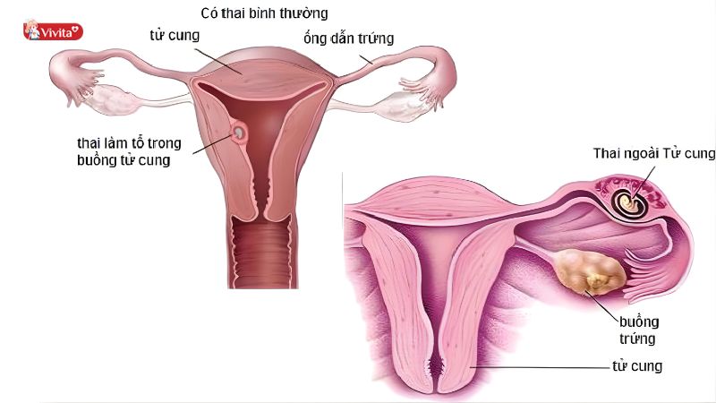 Nguyên nhân bệnh lý
