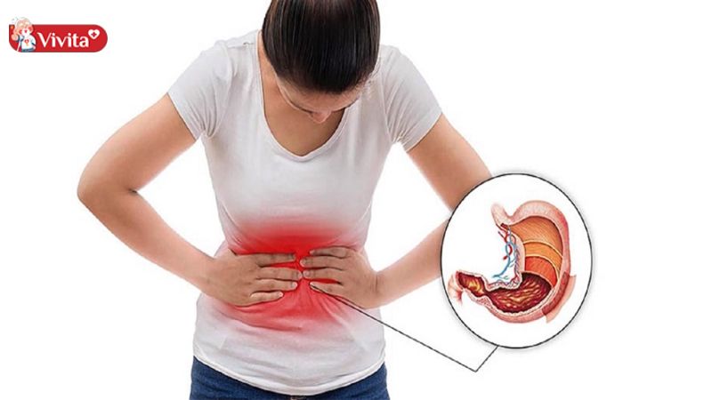 Cần lựa chọn thuốc dạ dày phù hợp với tình trạng bệnh, hoặc tham khảo ý kiến bác sĩ