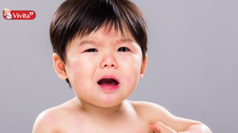 cách xử lý khi trẻ bị dị ứng thức ăn