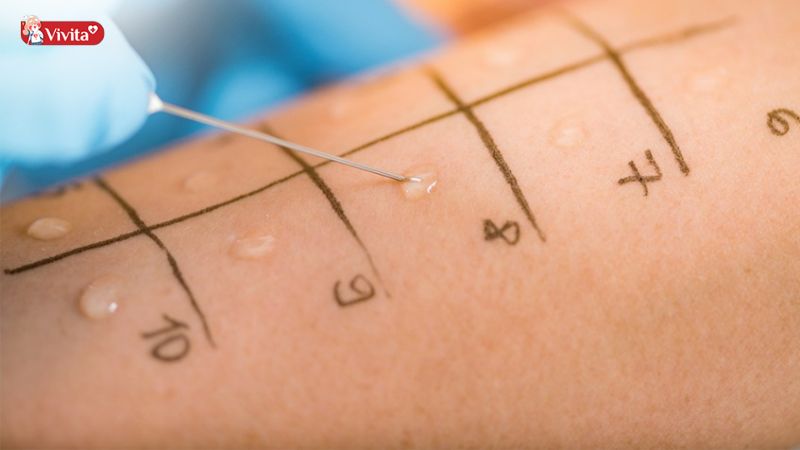 Chẩn đoán dị ứng thức ăn ở trẻ em