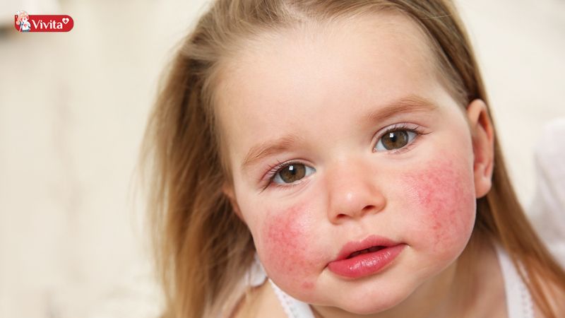 Theo dõi triệu chứng của trẻ