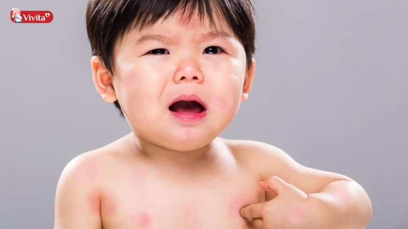 Triệu chứng nhẹ