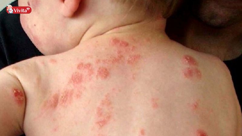 Xử lý theo từng mức độ