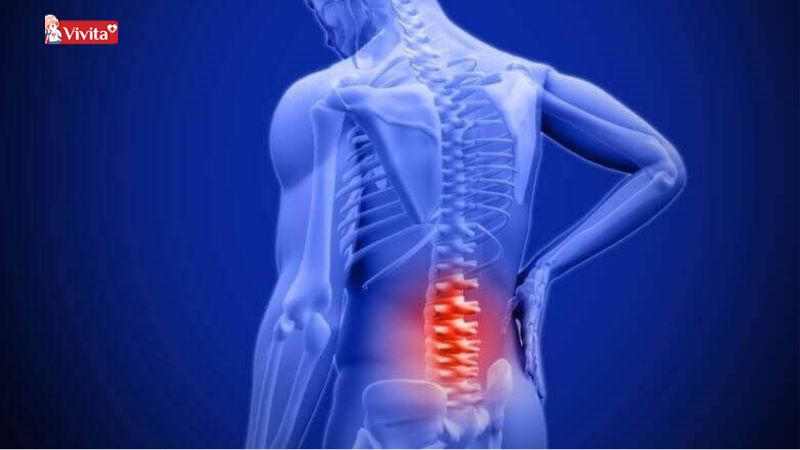 thuốc thoái hóa cột sống lưng của nhật
