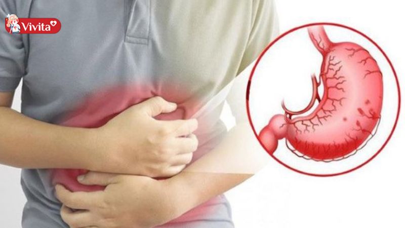 thuốc đau dạ dày của nhật